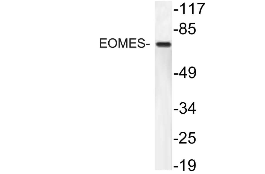Western Blot - Anti-EOMES Antibody (R12-2134) - Antibodies.com