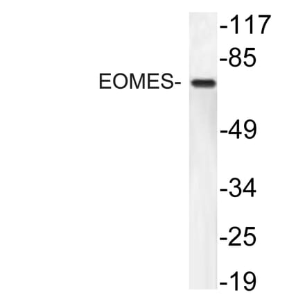 Western Blot - Anti-EOMES Antibody (R12-2134) - Antibodies.com