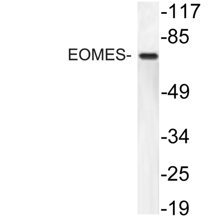 Western Blot - Anti-EOMES Antibody (R12-2134) - Antibodies.com