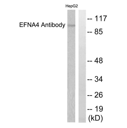 Western Blot - Anti-EFNA4 Antibody (C0181) - Antibodies.com