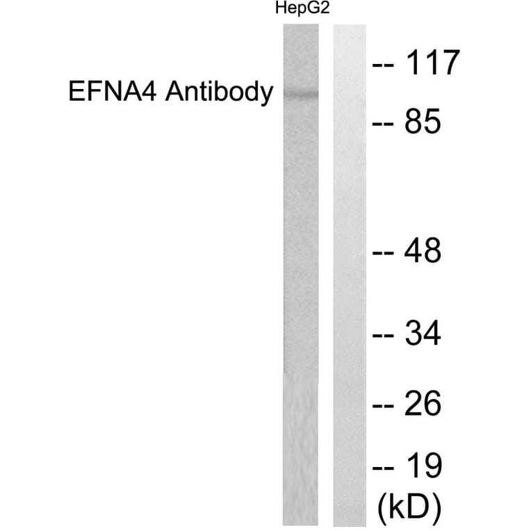 Western Blot - Anti-EFNA4 Antibody (C0181) - Antibodies.com