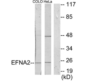 Western Blot - Anti-EFNA2 Antibody (C10124) - Antibodies.com