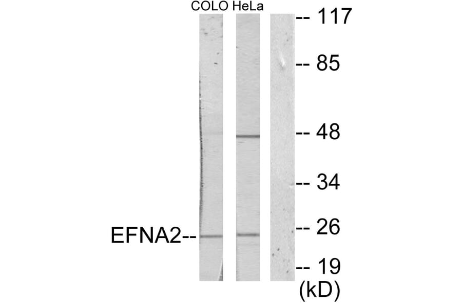 Western Blot - Anti-EFNA2 Antibody (C10124) - Antibodies.com