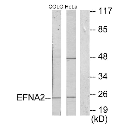Western Blot - Anti-EFNA2 Antibody (C10124) - Antibodies.com