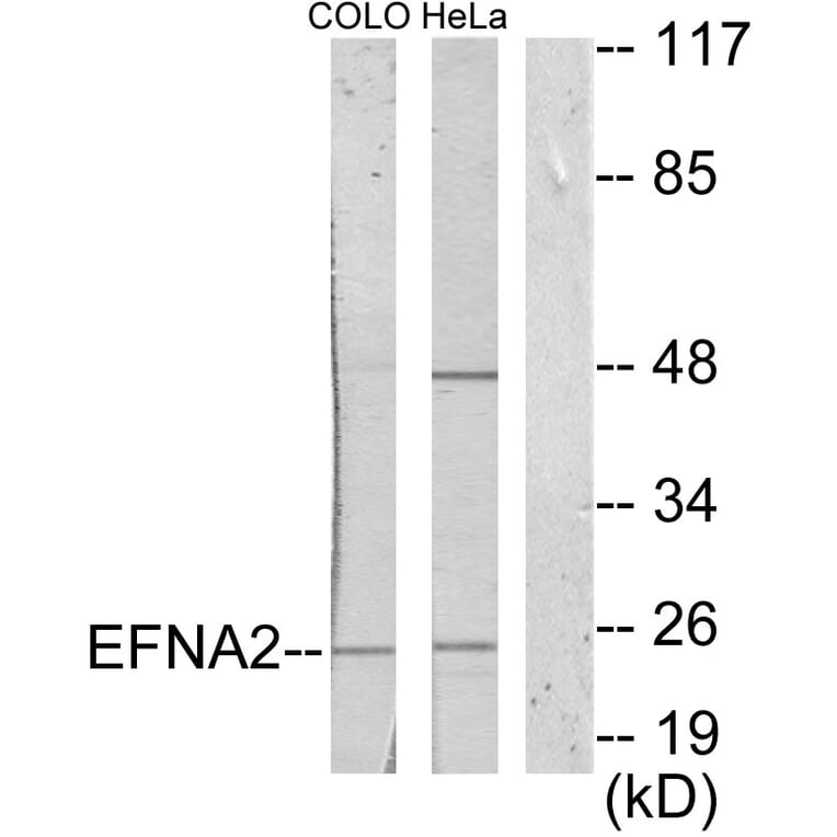 Western Blot - Anti-EFNA2 Antibody (C10124) - Antibodies.com