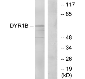 Western Blot - Anti-DYR1B Antibody (C11955) - Antibodies.com