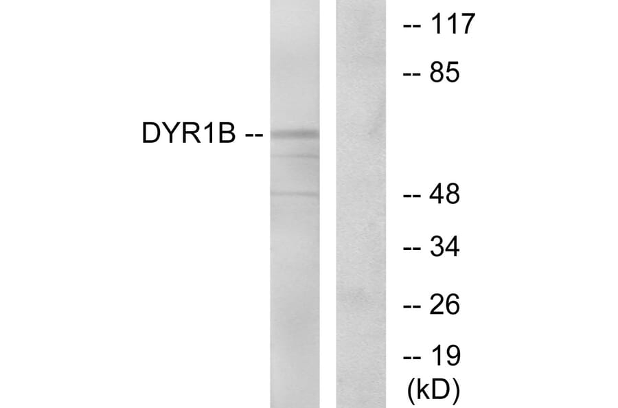 Western Blot - Anti-DYR1B Antibody (C11955) - Antibodies.com
