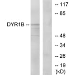 Western Blot - Anti-DYR1B Antibody (C11955) - Antibodies.com