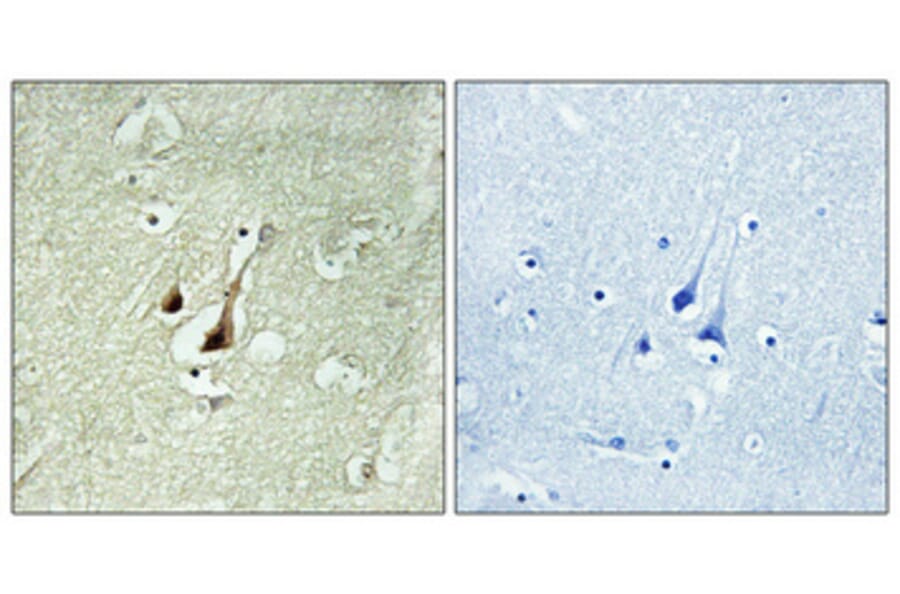 Immunohistochemistry - Anti-DYR1B Antibody (C11955) - Antibodies.com