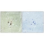 Immunohistochemistry - Anti-DYR1B Antibody (C11955) - Antibodies.com