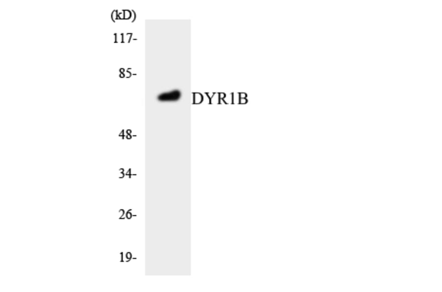 Western Blot - Anti-DYR1B Antibody (R12-2718) - Antibodies.com