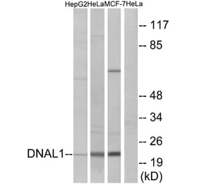 Western Blot - Anti-DNAL1 Antibody (C15512) - Antibodies.com