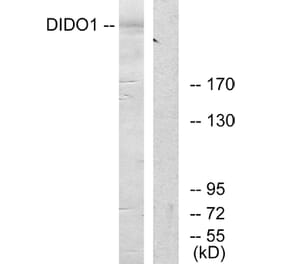 Western Blot - Anti-DIDO1 Antibody (C13042) - Antibodies.com