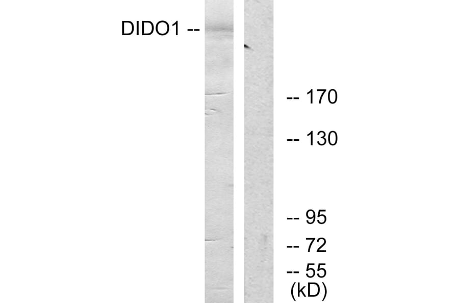 Western Blot - Anti-DIDO1 Antibody (C13042) - Antibodies.com
