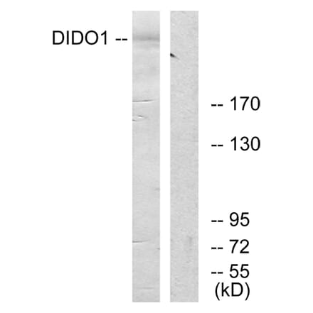 Western Blot - Anti-DIDO1 Antibody (C13042) - Antibodies.com