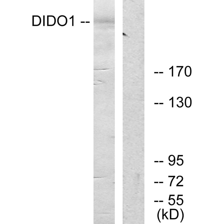 Western Blot - Anti-DIDO1 Antibody (C13042) - Antibodies.com