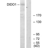 Western Blot - Anti-DIDO1 Antibody (C13042) - Antibodies.com