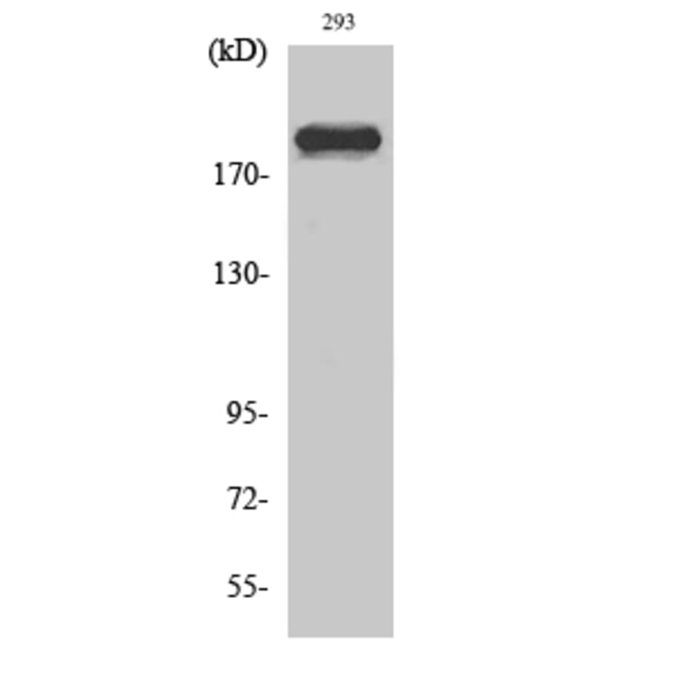 Western Blot - Anti-DIDO1 Antibody (C13042) - Antibodies.com