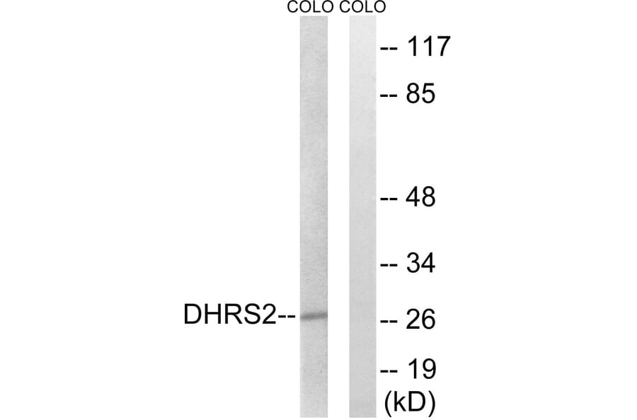 Western Blot - Anti-DHRS2 Antibody (C15322) - Antibodies.com