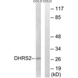 Western Blot - Anti-DHRS2 Antibody (C15322) - Antibodies.com