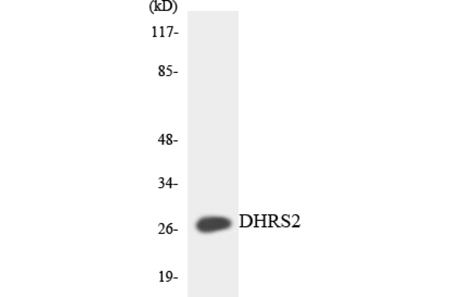 Western Blot - Anti-DHRS2 Antibody (R12-2696) - Antibodies.com