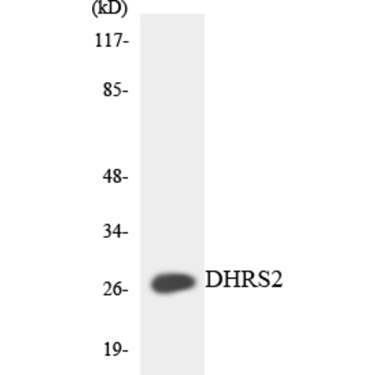 Western Blot - Anti-DHRS2 Antibody (R12-2696) - Antibodies.com