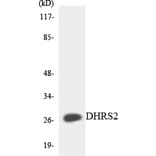 Western Blot - Anti-DHRS2 Antibody (R12-2696) - Antibodies.com