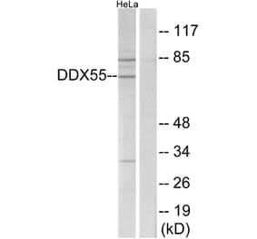 Western Blot - Anti-DDX55 Antibody (C14658) - Antibodies.com