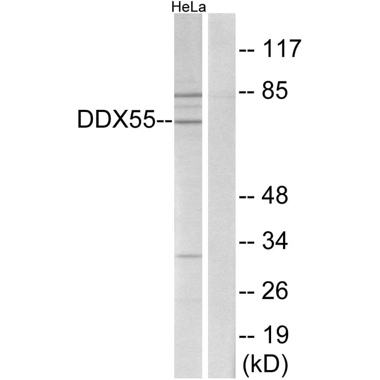 Western Blot - Anti-DDX55 Antibody (C14658) - Antibodies.com