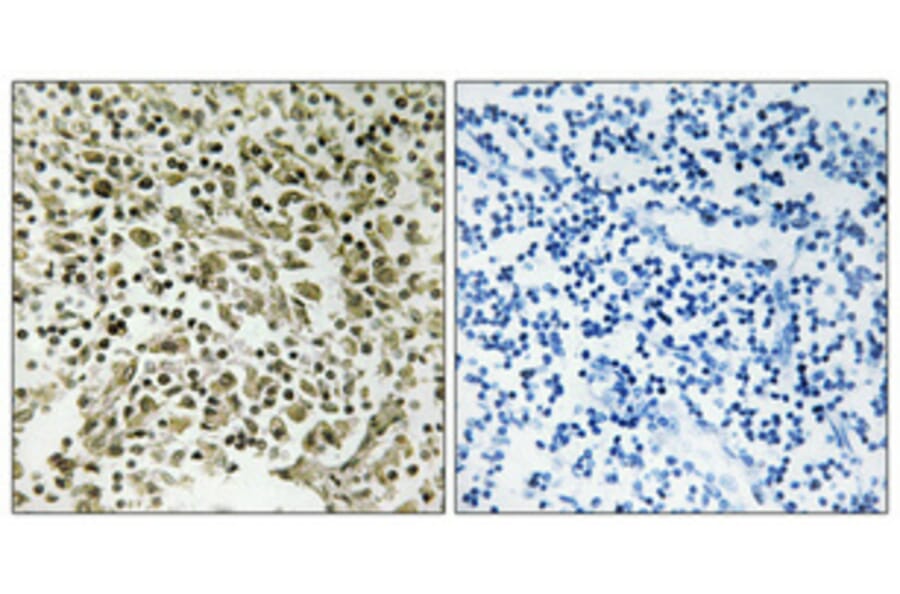 Immunohistochemistry - Anti-DDX55 Antibody (C14658) - Antibodies.com