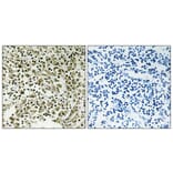 Immunohistochemistry - Anti-DDX55 Antibody (C14658) - Antibodies.com