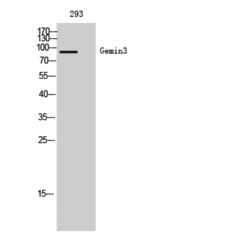 Western Blot - Anti-DDX20 Antibody (C17863) - Antibodies.com
