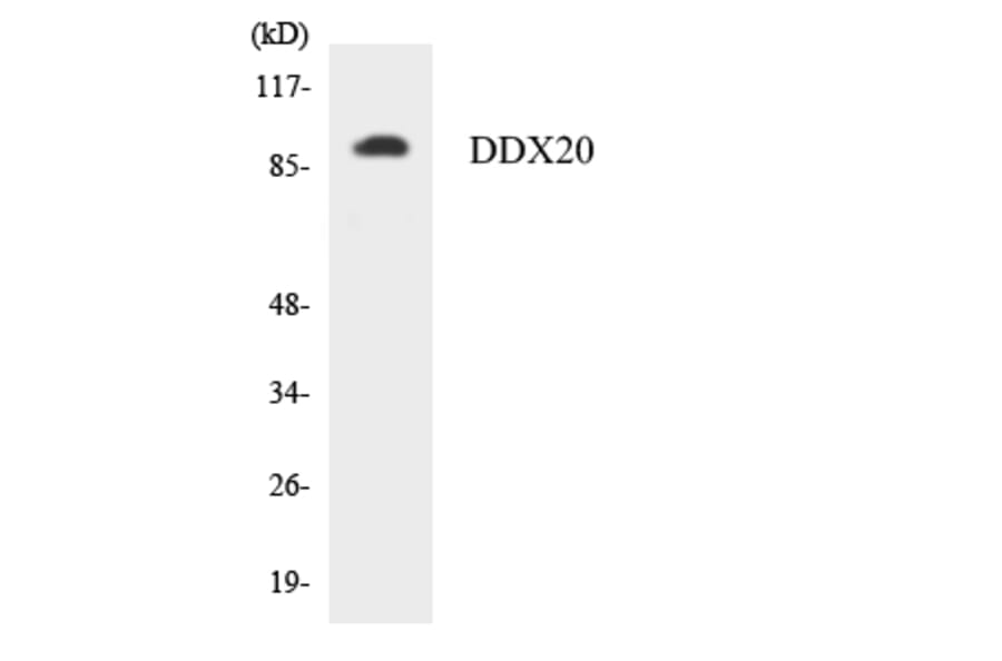 Western Blot - Anti-DDX20 Antibody (R12-2691) - Antibodies.com