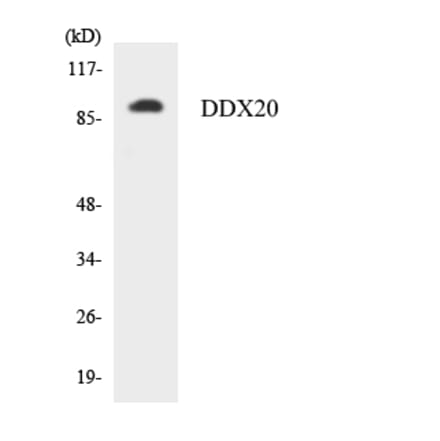 Western Blot - Anti-DDX20 Antibody (R12-2691) - Antibodies.com