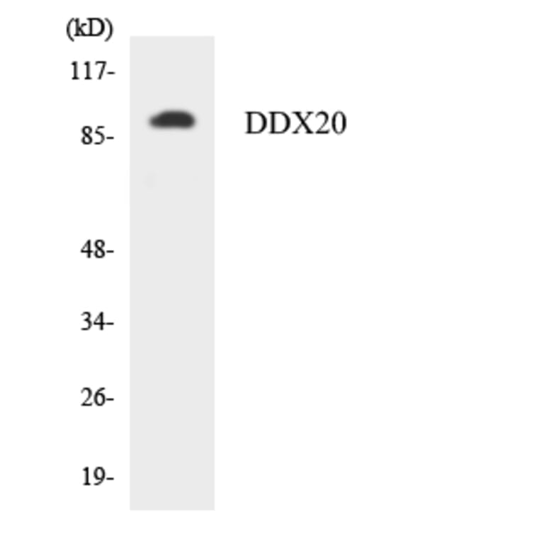 Western Blot - Anti-DDX20 Antibody (R12-2691) - Antibodies.com