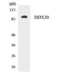Western Blot - Anti-DDX20 Antibody (R12-2691) - Antibodies.com