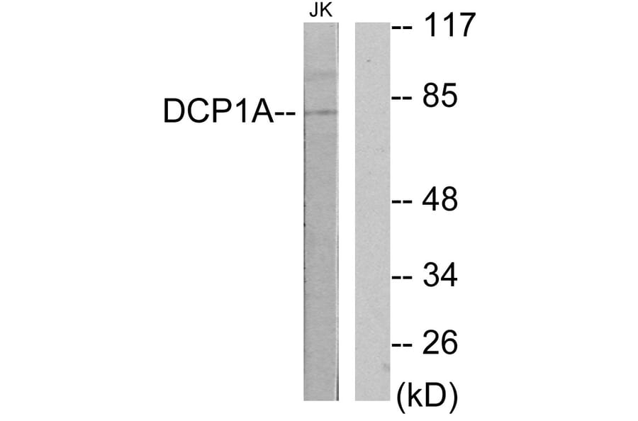 Western Blot - Anti-DCP1A Antibody (C11740) - Antibodies.com