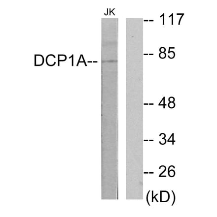 Western Blot - Anti-DCP1A Antibody (C11740) - Antibodies.com