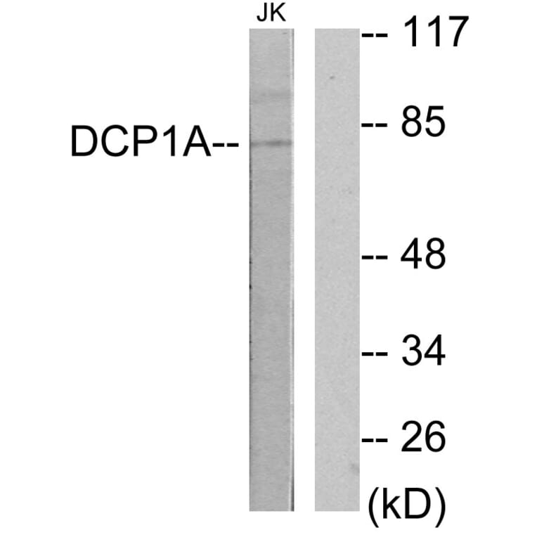 Western Blot - Anti-DCP1A Antibody (C11740) - Antibodies.com