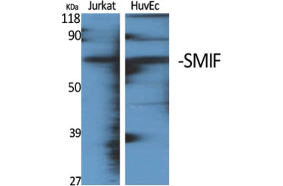 Western Blot - Anti-DCP1A Antibody (C11740) - Antibodies.com