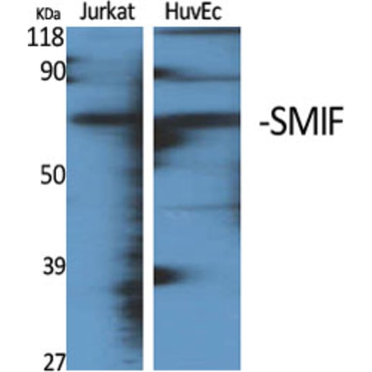 Western Blot - Anti-DCP1A Antibody (C11740) - Antibodies.com