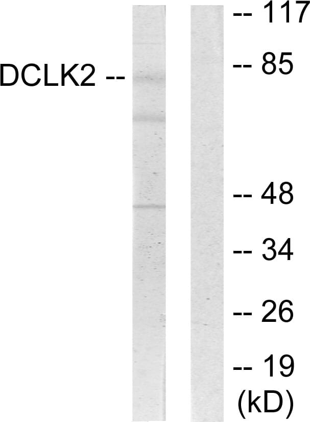 Western blot analysis of lysates from HepG2 cells using Anti-DCLK2 Antibody. The right hand lane represents a negative control, where the antibody is blocked by the immunising peptide.