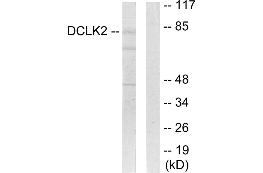 Western Blot - Anti-DCLK2 Antibody (C11345) - Antibodies.com