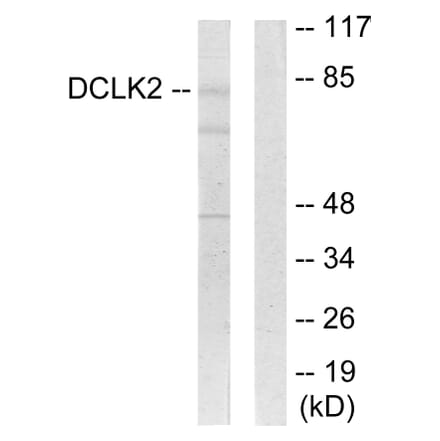 Western Blot - Anti-DCLK2 Antibody (C11345) - Antibodies.com
