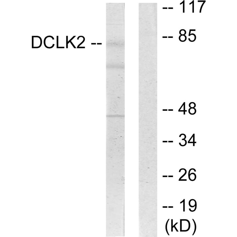 Western Blot - Anti-DCLK2 Antibody (C11345) - Antibodies.com