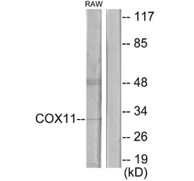 Western Blot - Anti-COX11 Antibody (C12229) - Antibodies.com