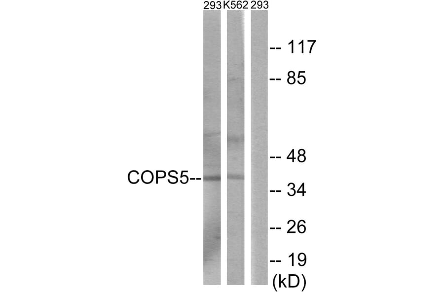 Western Blot - Anti-COPS5 Antibody (C11442) - Antibodies.com