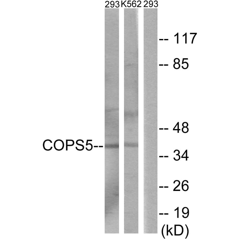 Western Blot - Anti-COPS5 Antibody (C11442) - Antibodies.com