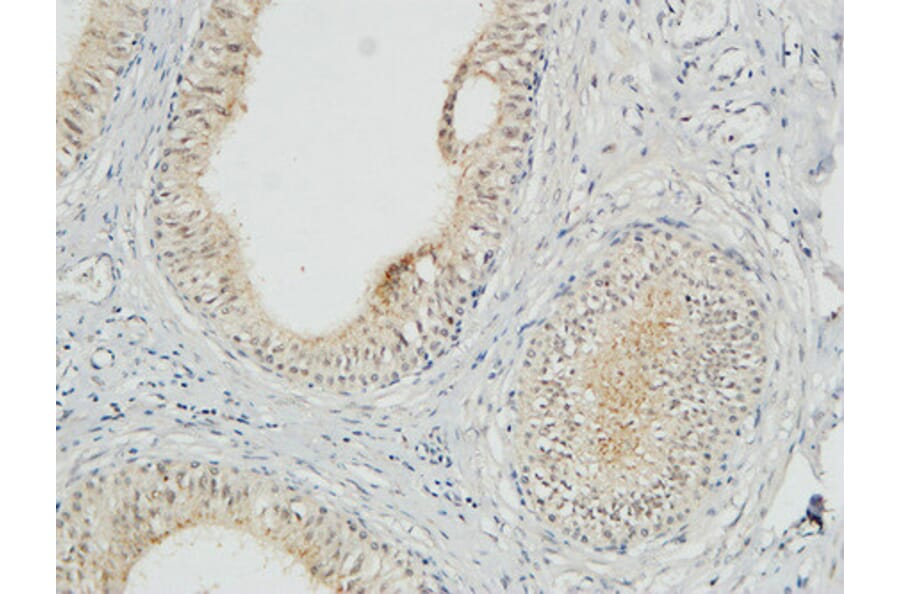 Immunohistochemistry - Anti-COPS5 Antibody (C11442) - Antibodies.com