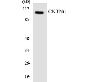 Western Blot - Anti-CNTN6 Antibody (R12-2638) - Antibodies.com